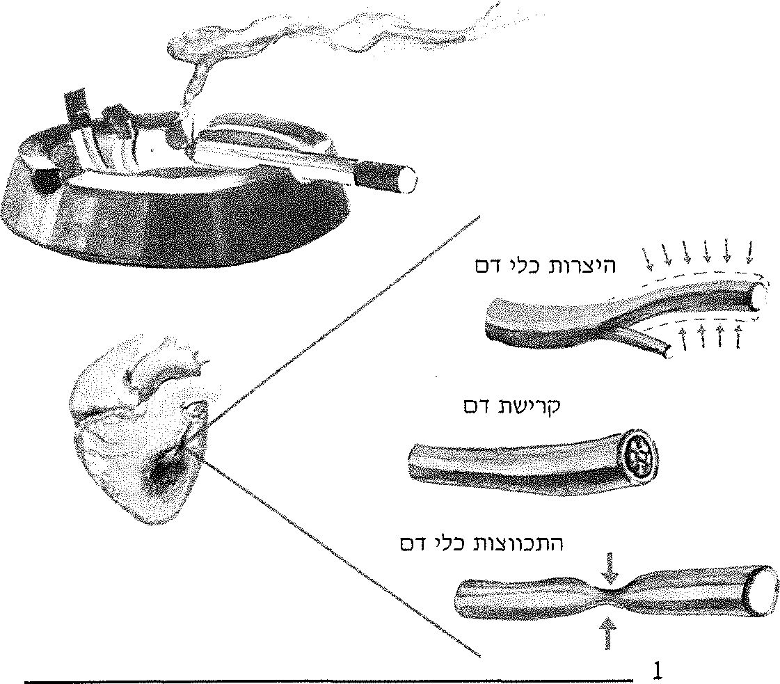 היצרות כלי דם, קרישת דם, התכווצות כלי דם